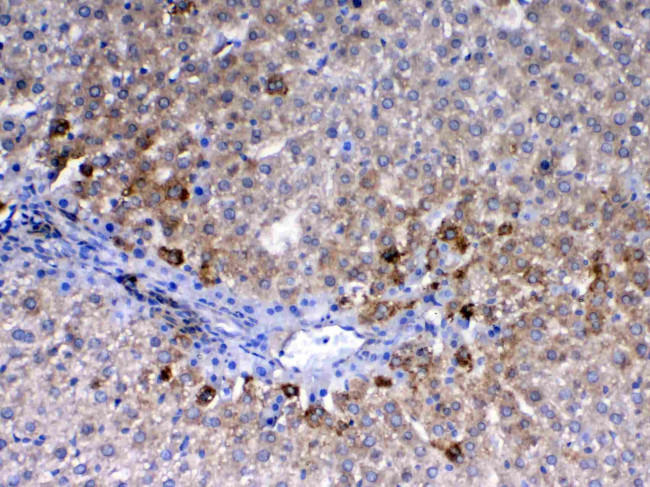 CD105 (Endoglin) Antibody in Immunohistochemistry (Paraffin) (IHC (P))