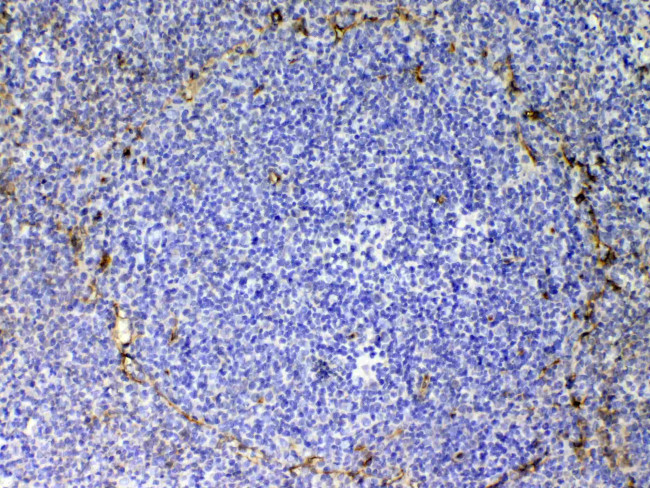 CD105 (Endoglin) Antibody in Immunohistochemistry (Paraffin) (IHC (P))