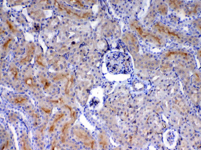 CD105 (Endoglin) Antibody in Immunohistochemistry (Paraffin) (IHC (P))