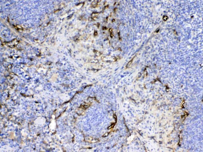 CD105 (Endoglin) Antibody in Immunohistochemistry (Paraffin) (IHC (P))