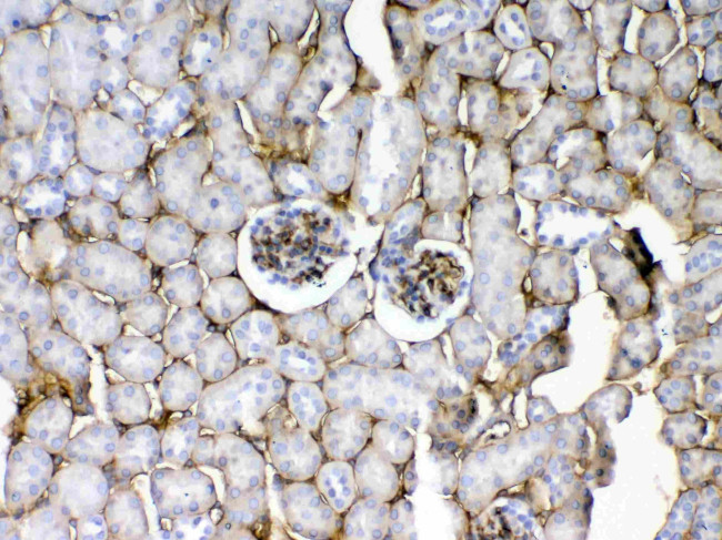 CD105 (Endoglin) Antibody in Immunohistochemistry (Paraffin) (IHC (P))