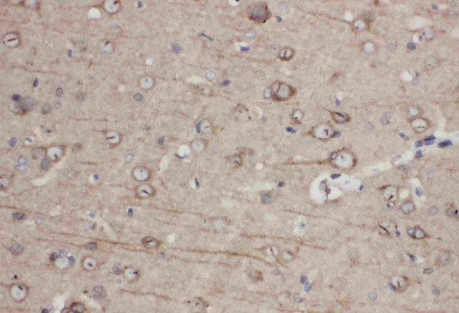 EphA1 Antibody in Immunohistochemistry (Paraffin) (IHC (P))