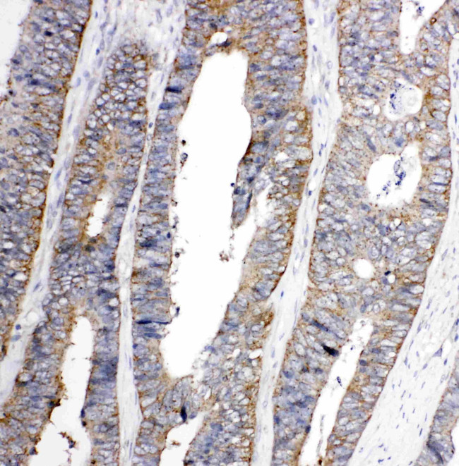 EphA1 Antibody in Immunohistochemistry (Paraffin) (IHC (P))