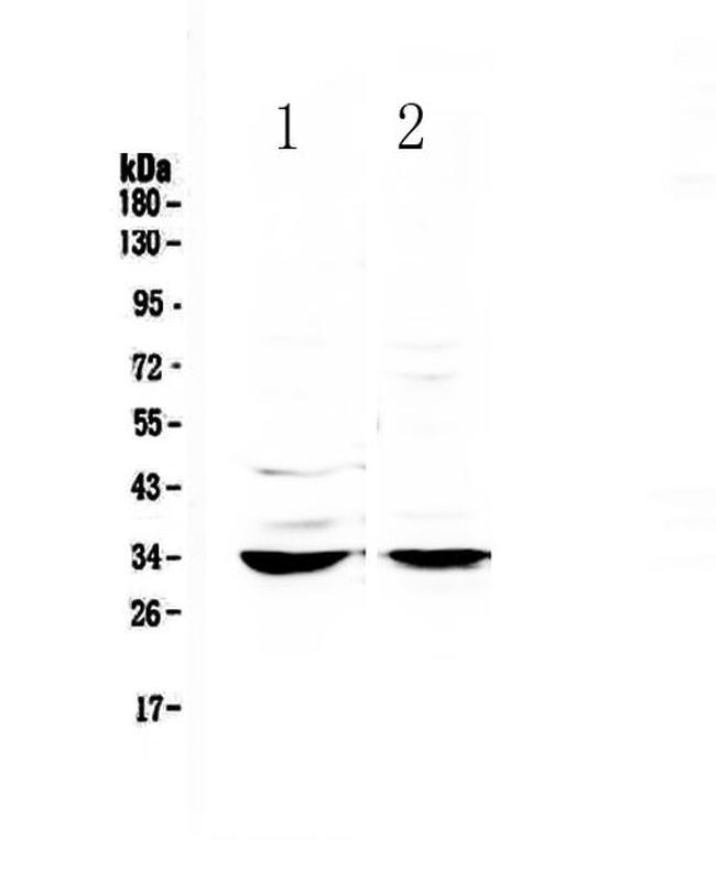 ERCC1 Antibody in Western Blot (WB)