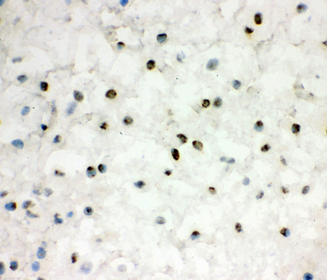 EWSR1 Antibody in Immunohistochemistry (Frozen) (IHC (F))