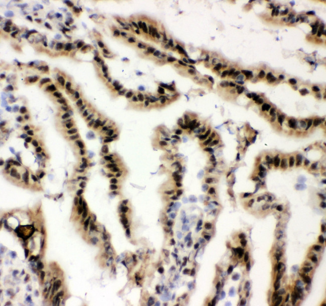 EWSR1 Antibody in Immunohistochemistry (Frozen) (IHC (F))