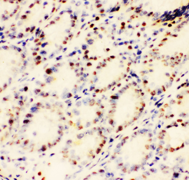 EWSR1 Antibody in Immunohistochemistry (Frozen) (IHC (F))