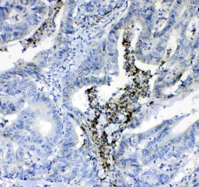 Prothrombin Antibody in Immunohistochemistry (Paraffin) (IHC (P))