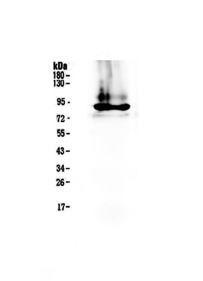 Prothrombin Antibody in Western Blot (WB)