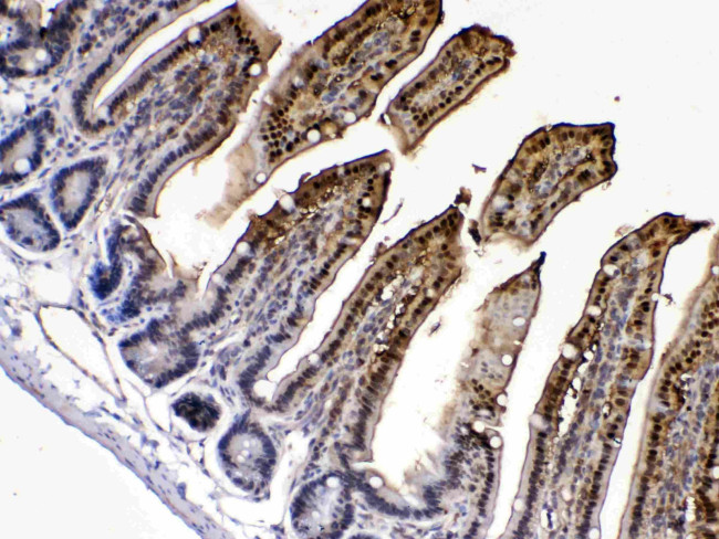 FABP2 Antibody in Immunohistochemistry (Paraffin) (IHC (P))