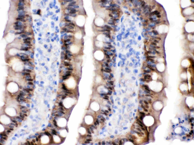 FABP2 Antibody in Immunohistochemistry (Paraffin) (IHC (P))