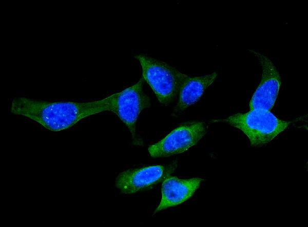 FABP5 Antibody in Immunocytochemistry (ICC/IF)