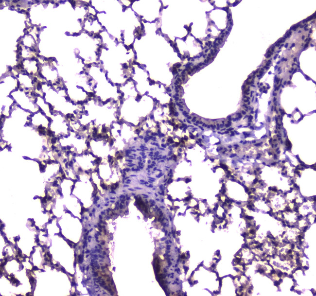 FABP5 Antibody in Immunohistochemistry (Paraffin) (IHC (P))