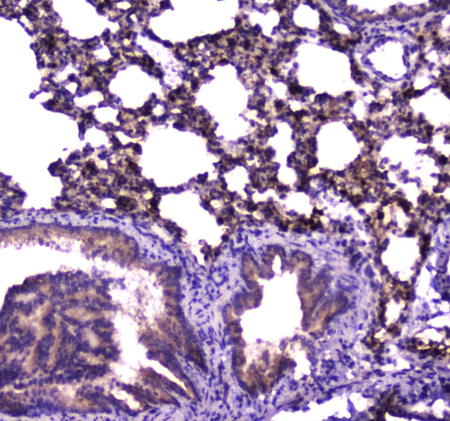 FABP5 Antibody in Immunohistochemistry (Paraffin) (IHC (P))