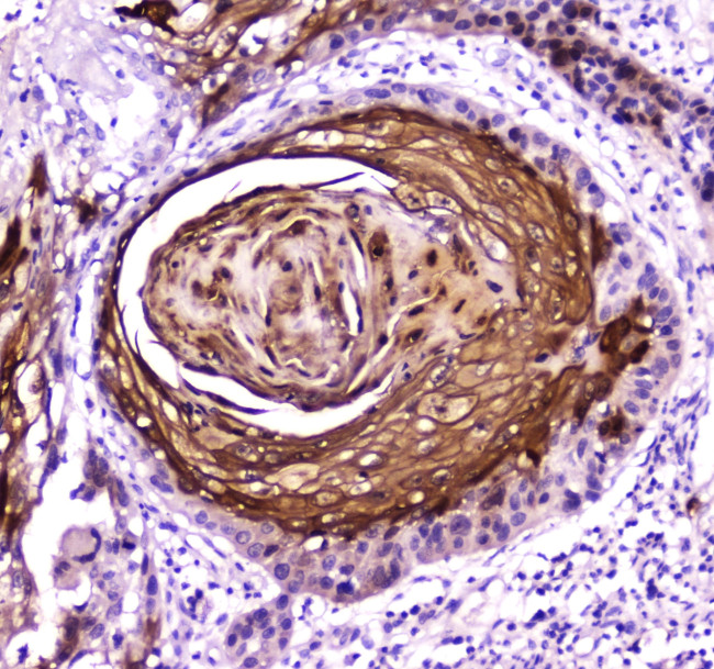 FABP5 Antibody in Immunohistochemistry (Paraffin) (IHC (P))