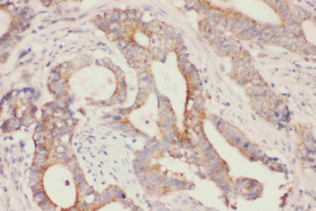 FABP5 Antibody in Immunohistochemistry (Paraffin) (IHC (P))