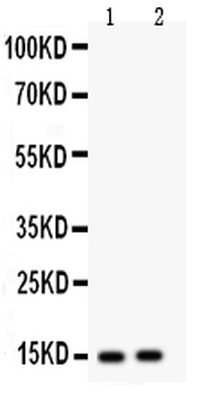 FABP5 Antibody in Western Blot (WB)