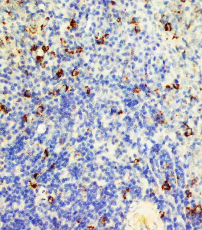 FAS (CD95) Antibody in Immunohistochemistry (Paraffin) (IHC (P))