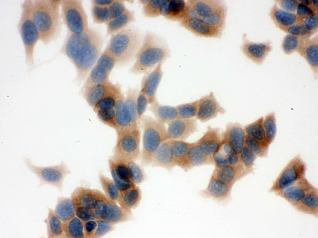 FASN Antibody in Immunocytochemistry (ICC/IF)