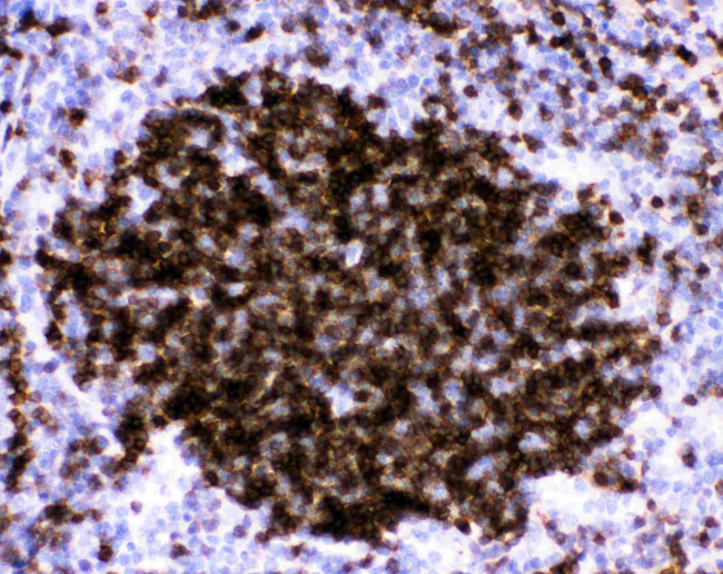 CD23 Antibody in Immunohistochemistry (Paraffin) (IHC (P))