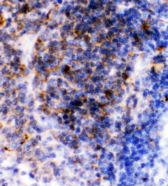 CD23 Antibody in Immunohistochemistry (Paraffin) (IHC (P))