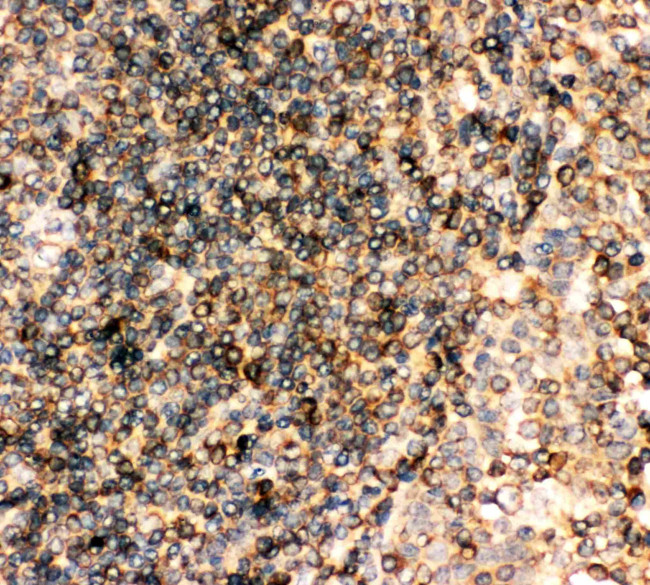 CD23 Antibody in Immunohistochemistry (Paraffin) (IHC (P))