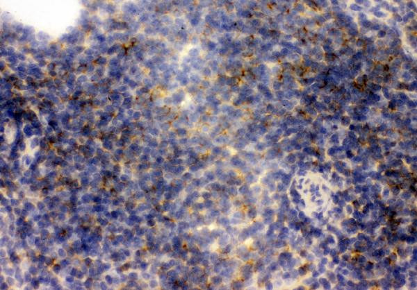 CD23 Antibody in Immunohistochemistry (Frozen) (IHC (F))