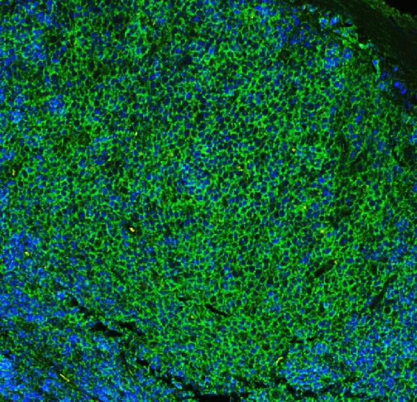 CD23 Antibody in Immunohistochemistry (Paraffin) (IHC (P))