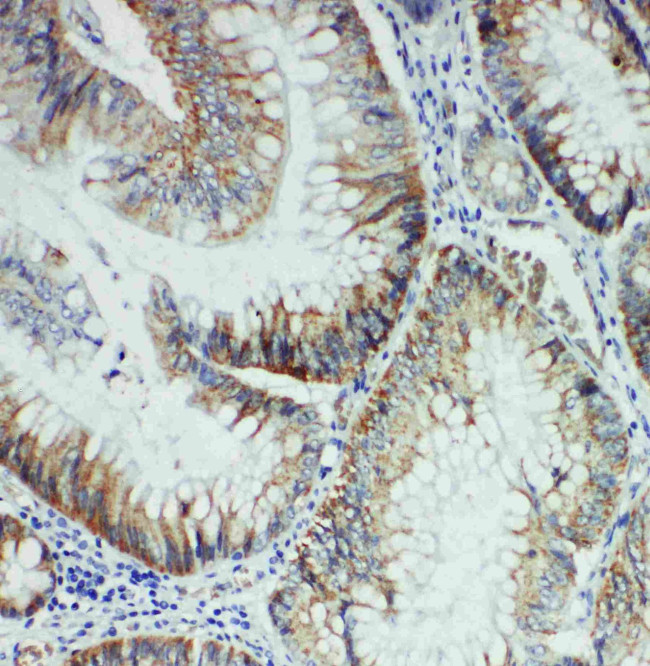 FER Antibody in Immunohistochemistry (Paraffin) (IHC (P))