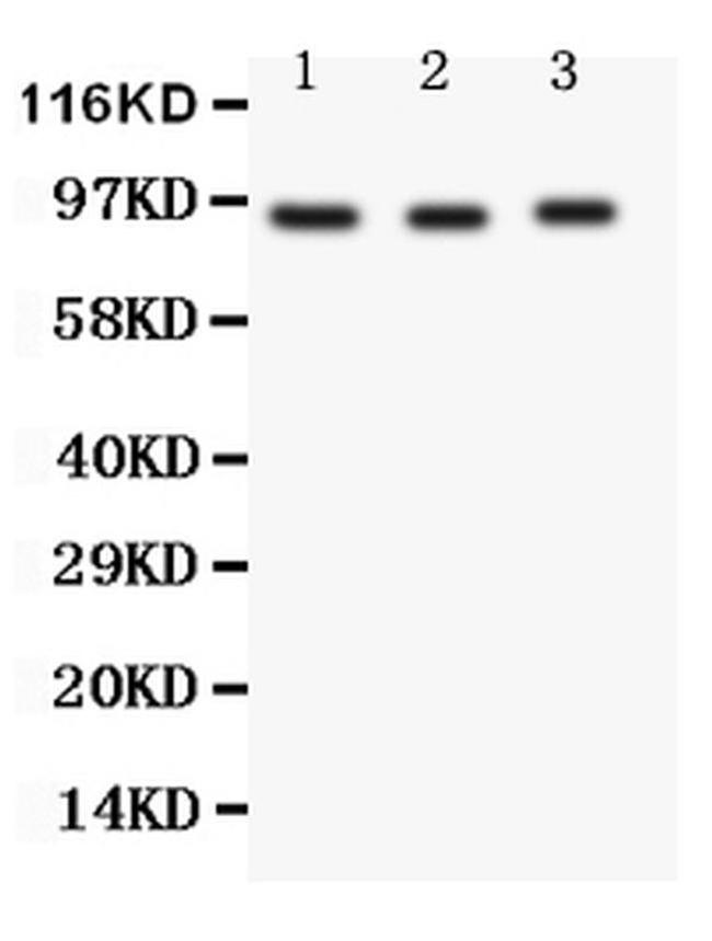 FER Antibody in Western Blot (WB)