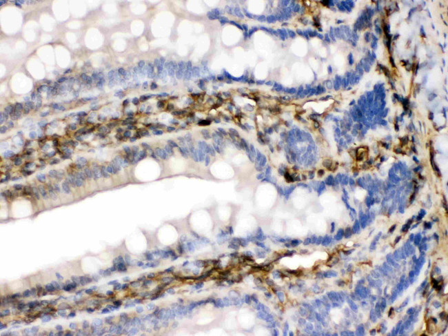 FGF1 Antibody in Immunohistochemistry (Paraffin) (IHC (P))