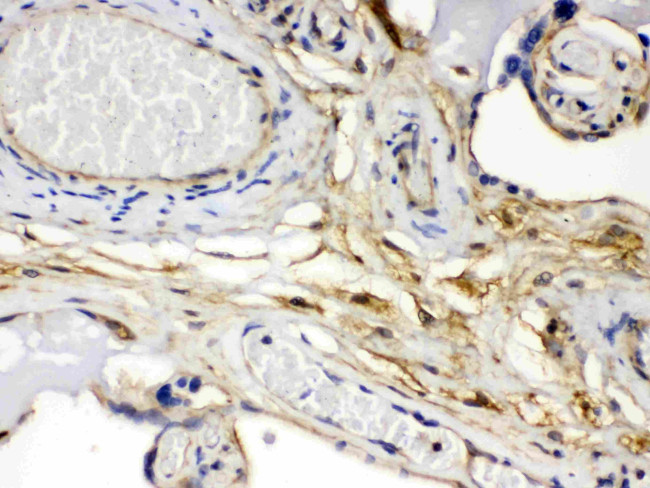 FGF1 Antibody in Immunohistochemistry (Paraffin) (IHC (P))