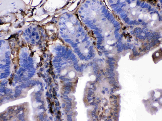 FGF1 Antibody in Immunohistochemistry (Paraffin) (IHC (P))