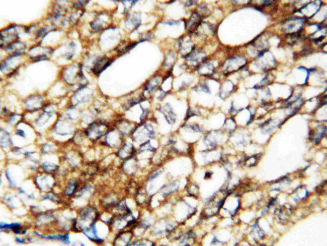 FGF1 Antibody in Immunohistochemistry (Paraffin) (IHC (P))