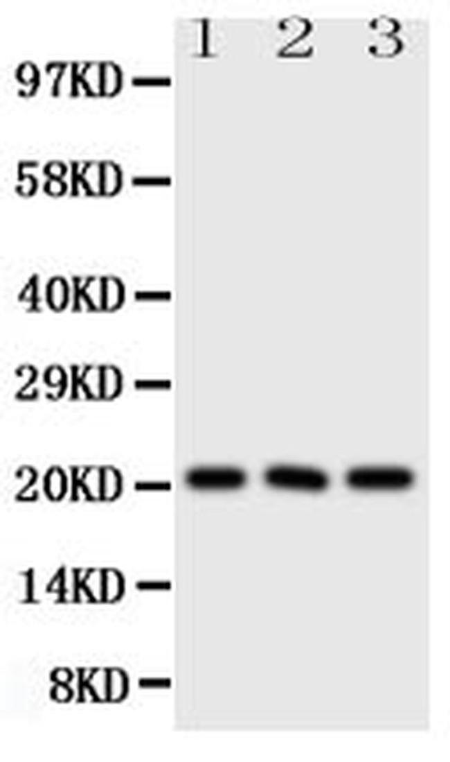 FGF21 Antibody in Western Blot (WB)