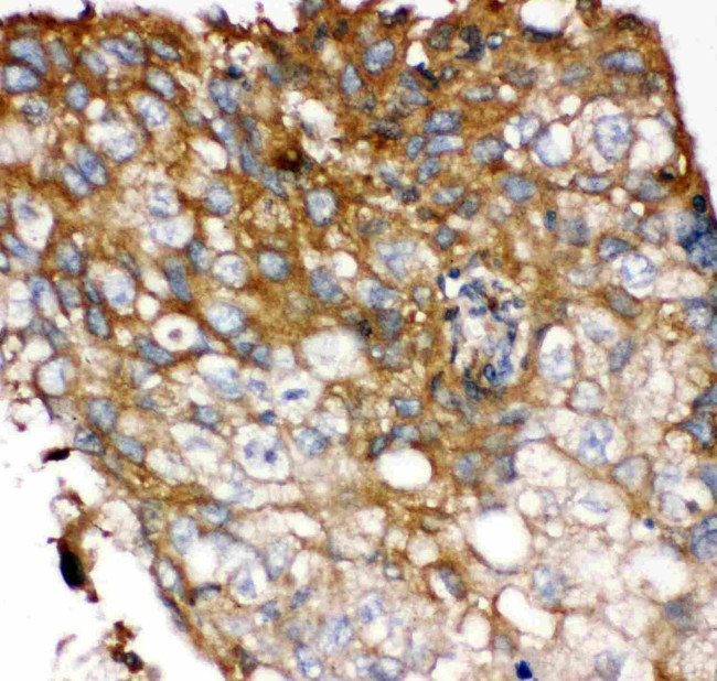 FGFR4 Antibody in Immunohistochemistry (Paraffin) (IHC (P))