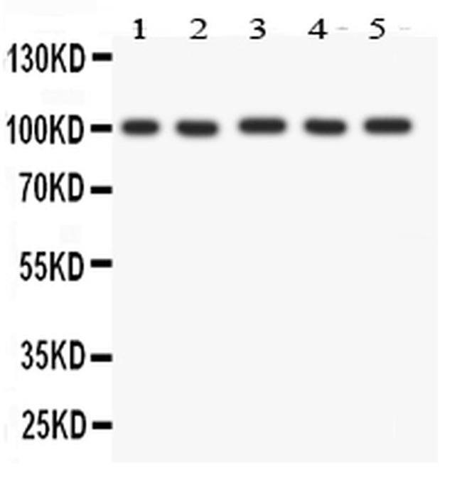 FGFR4 Antibody in Western Blot (WB)