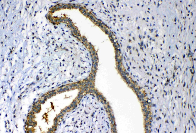 Fumarase Antibody in Immunohistochemistry (Paraffin) (IHC (P))