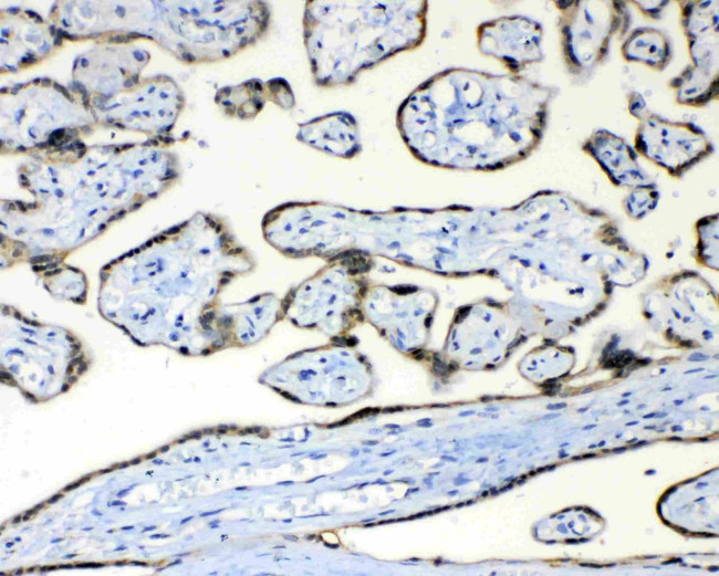 Fumarase Antibody in Immunohistochemistry (Paraffin) (IHC (P))