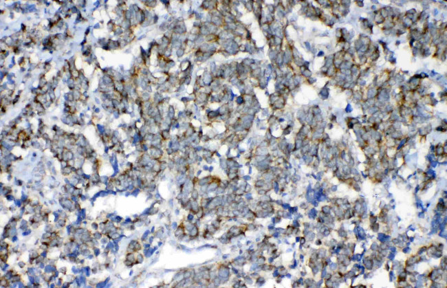 Fumarase Antibody in Immunohistochemistry (Paraffin) (IHC (P))