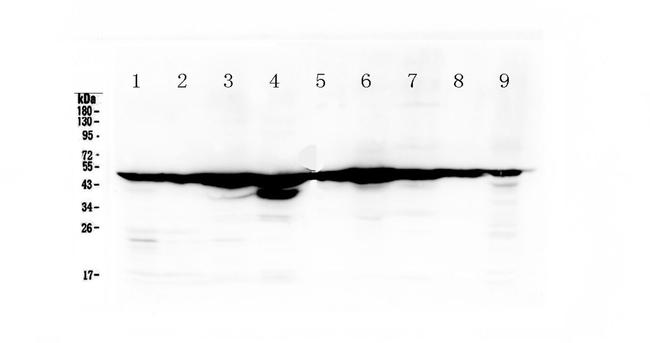 Fumarase Antibody in Western Blot (WB)