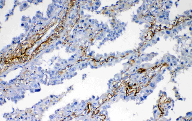 VEGFD Antibody in Immunohistochemistry (Paraffin) (IHC (P))