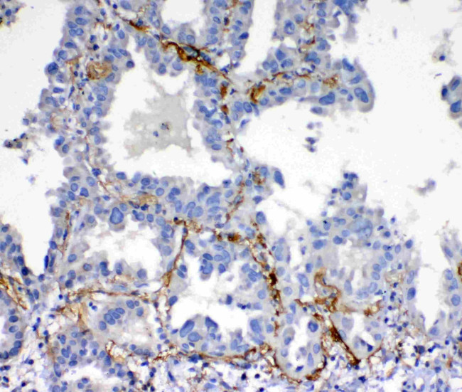 VEGFD Antibody in Immunohistochemistry (Paraffin) (IHC (P))