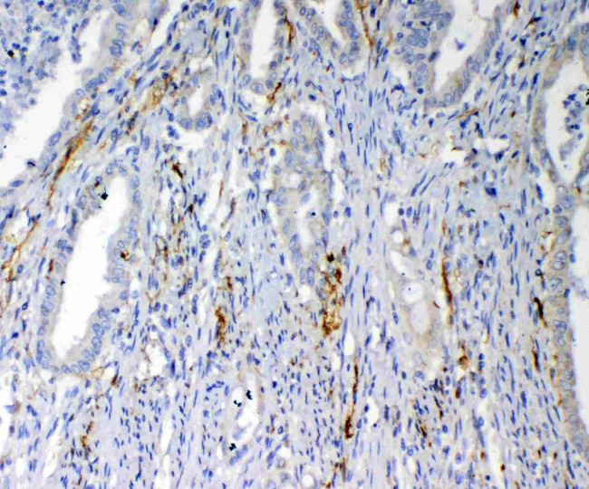 VEGFD Antibody in Immunohistochemistry (Paraffin) (IHC (P))