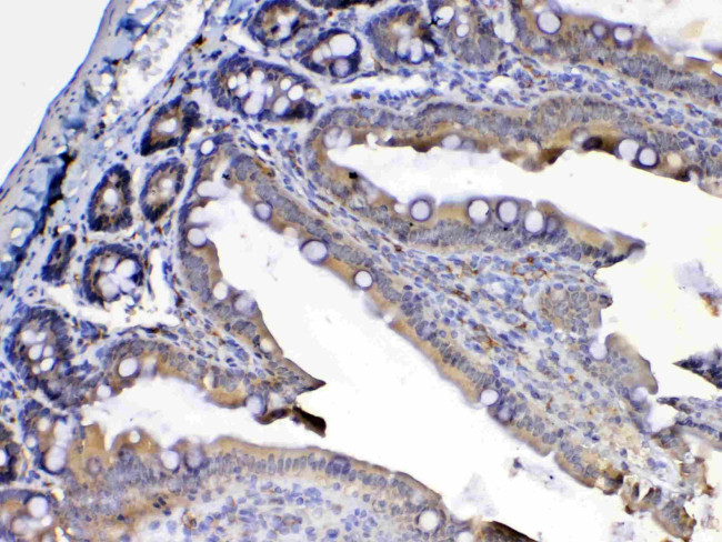 FLT3 (CD135) Antibody in Immunohistochemistry (Paraffin) (IHC (P))