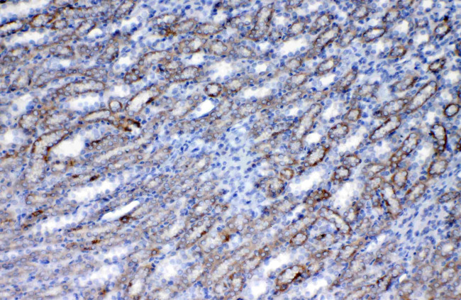 FLT3 (CD135) Antibody in Immunohistochemistry (Paraffin) (IHC (P))