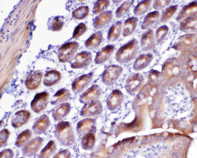 FLT3 (CD135) Antibody in Immunohistochemistry (Paraffin) (IHC (P))