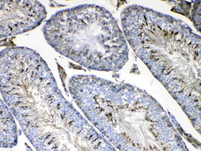 FMN1 Antibody in Immunohistochemistry (Paraffin) (IHC (P))