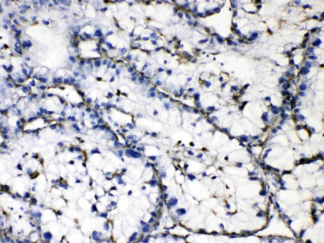 GAA Antibody in Immunohistochemistry (Paraffin) (IHC (P))