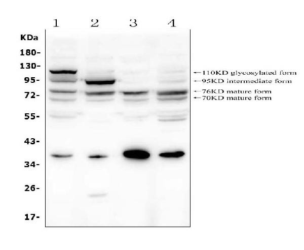 GAA Antibody in Western Blot (WB)